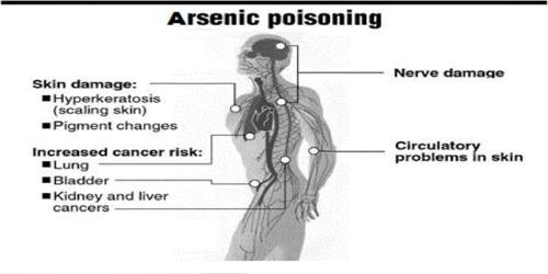 Arsenic-Poisoning
