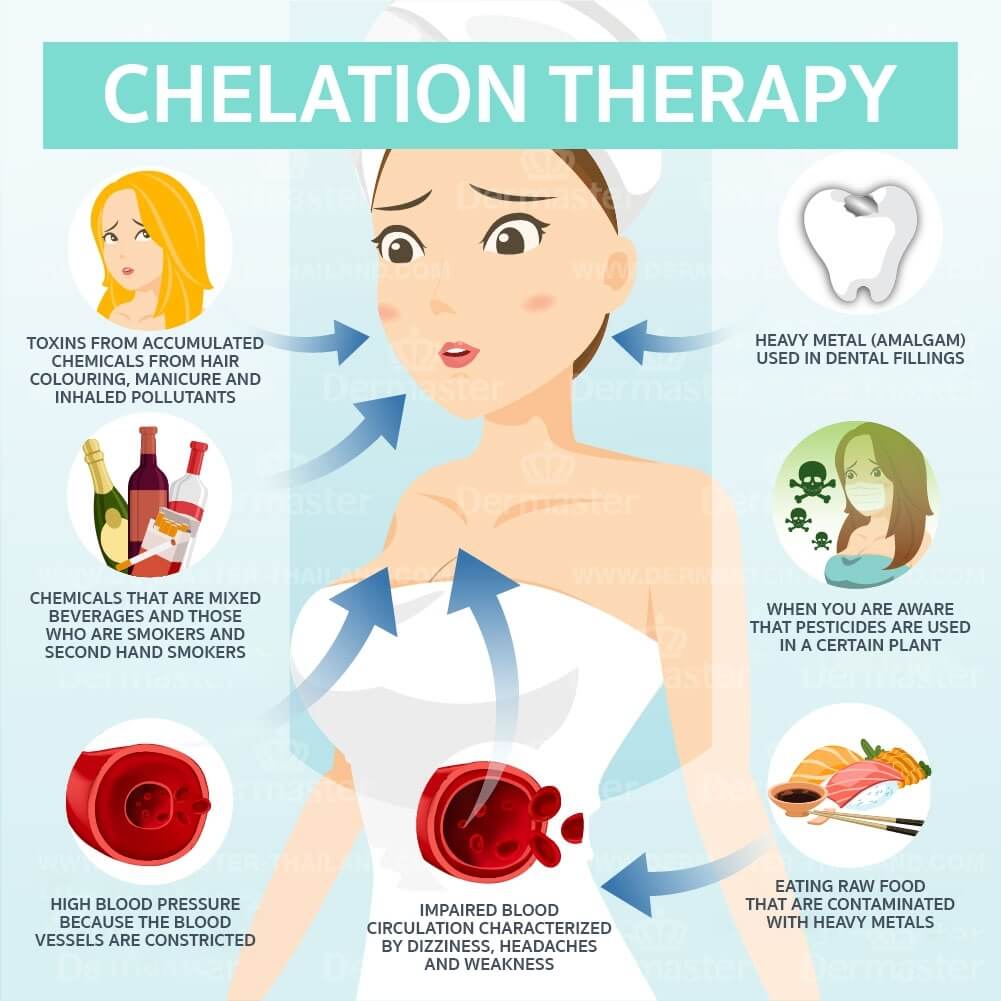 Chelation Therapy in Heavy Metal Detoxification