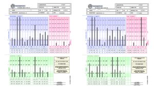 Checking for Heavy Metals in Autistic Children