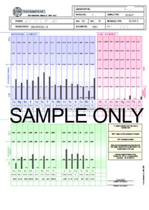 HAIR MINERAL test