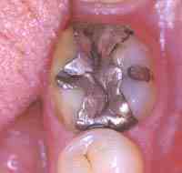 | Naturopathic Practitioner with Mercury Symptoms