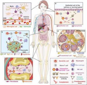 Immune System and Heavy Metals